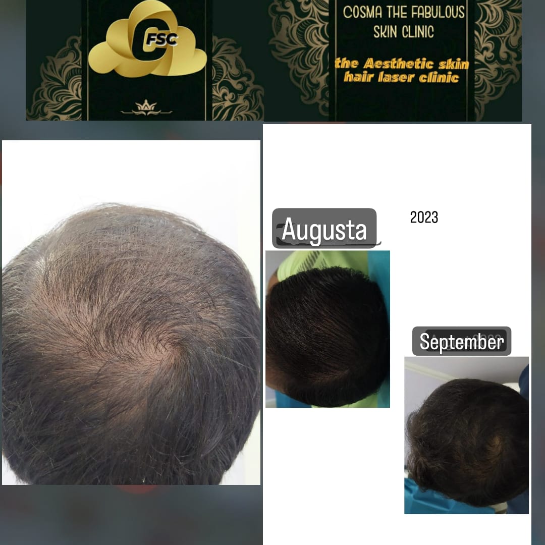 Before After Skin Treatment